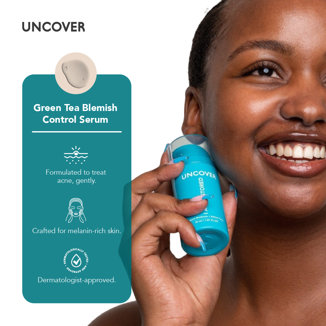 UNCOVER GREEN TEA BLEMISH CONTROL SERUM