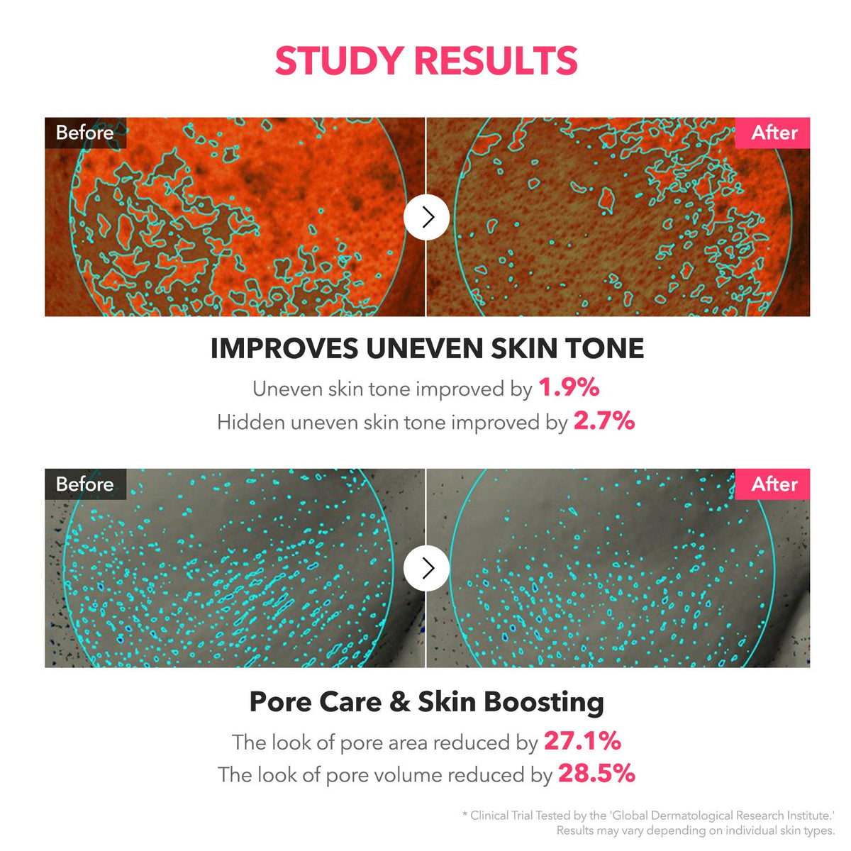 APRILSKIN TXA NIACINAMIDE TONING SHOT 99 SERUM (99% PURITY TXA + NIACINAMIDE 5% + ALPHA-ARBUTIN)