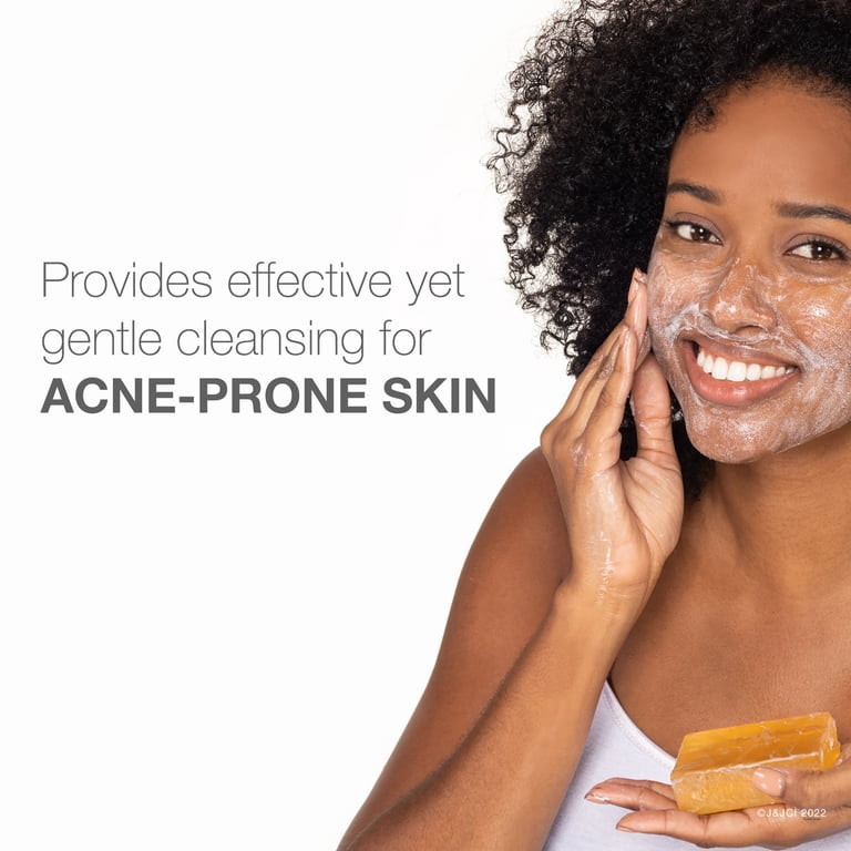 NEUTROGENA THE TRANSPARENT FACIAL BAR (ACNE-PRONE SKIN) - 99g