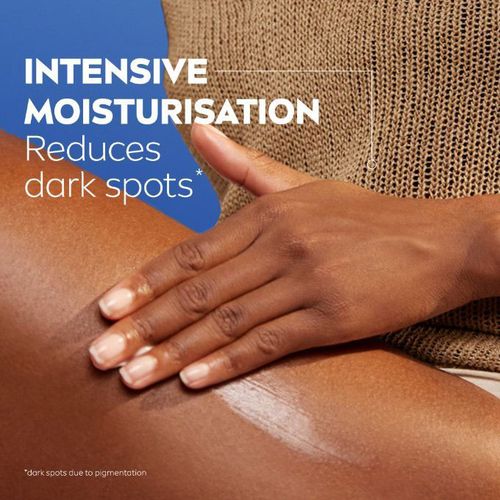 NIVEA PERFECT & RADIANT EVEN TONE BODY LOTION (WITH VITAMIN C, 100% PURE HYALURON & UVA/UVB FILTER) - 400ML (new look)