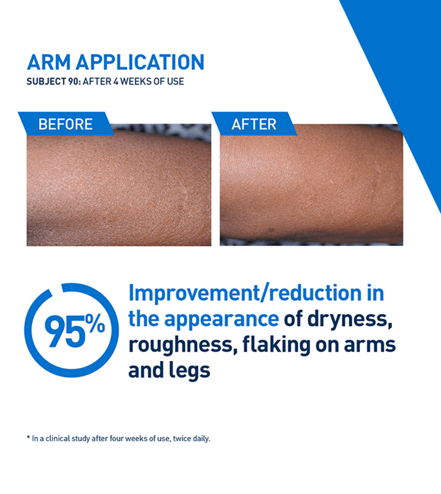 CERAVE INTENSIVE MOISTURIZING LOTION 473ML