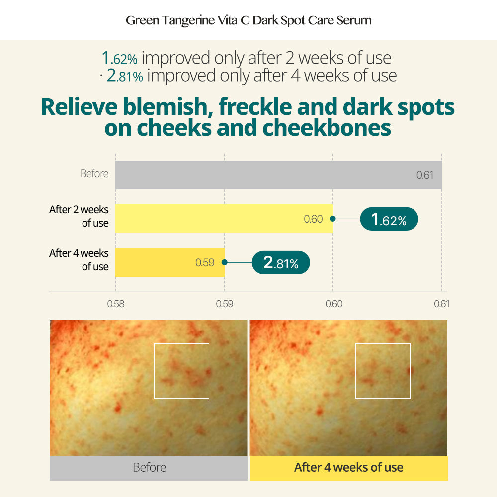 GOODAL GREEN TANGERINE VITA C DARK SPOT SERUM 40ML