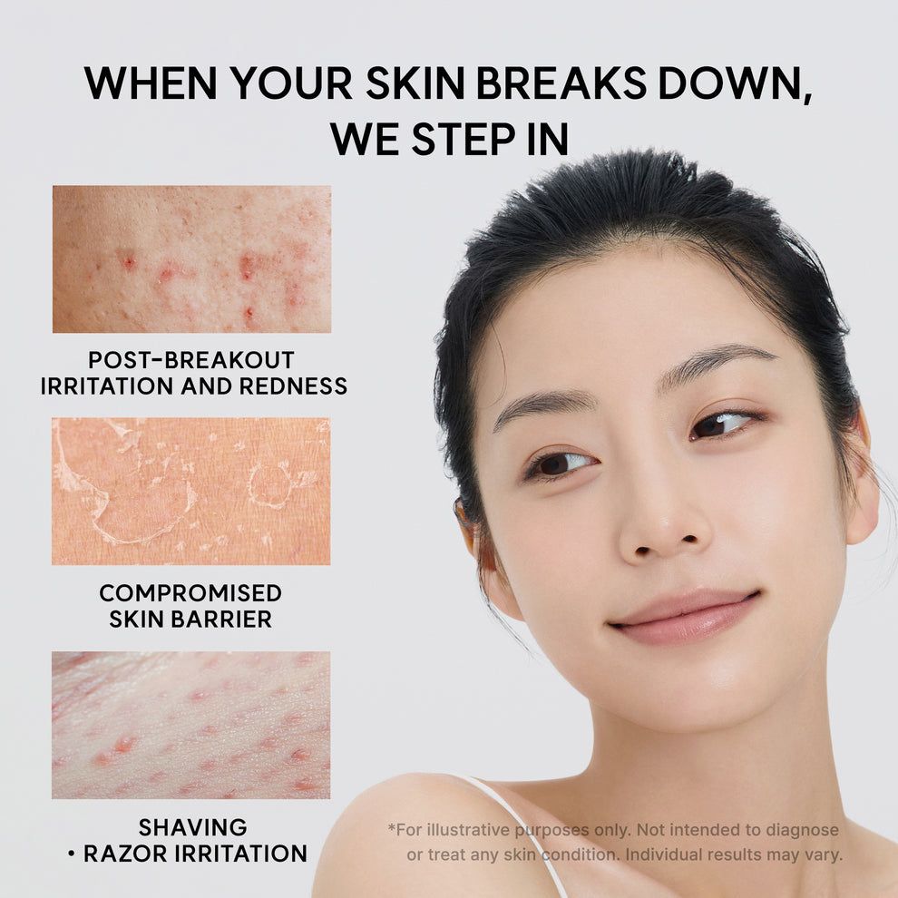ARENCIA ERASER SOOTHING CREAM