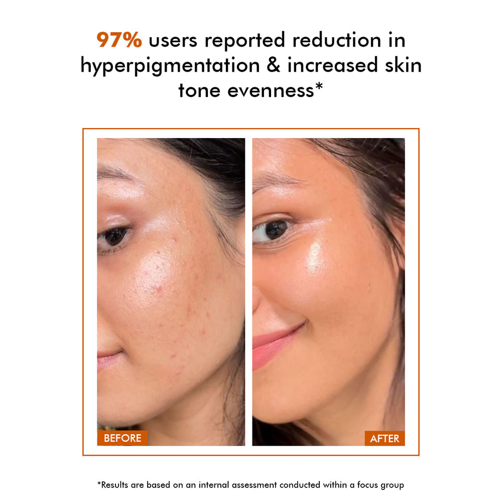 CONSCIOUS CHEMIST VIVID C 10% VITAMIN C SKIN BRIGHTENING SERUM - 30 ML