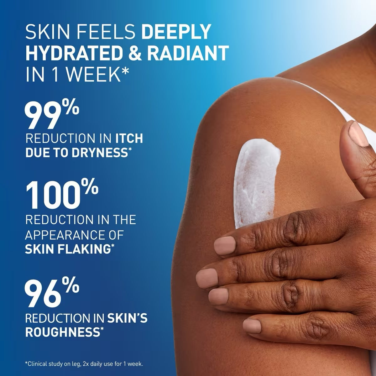 CERAVE INTENSIVE MOISTURIZING CREAM (WITH 5% HYDRO-UREA™ & ESSENTIAL CERAMIDES - 539g / 190z